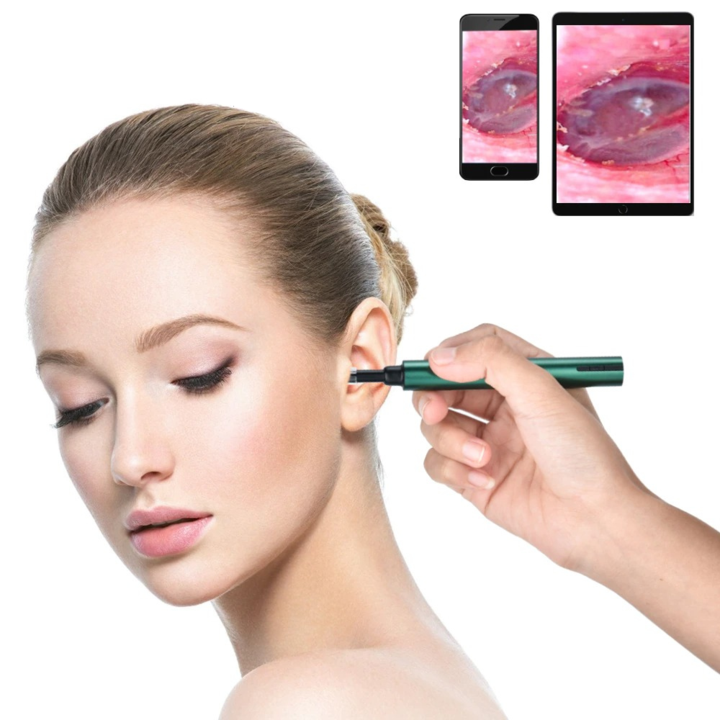 Ear Wax Removal Tool With Camera - Smart Ear Cleaning